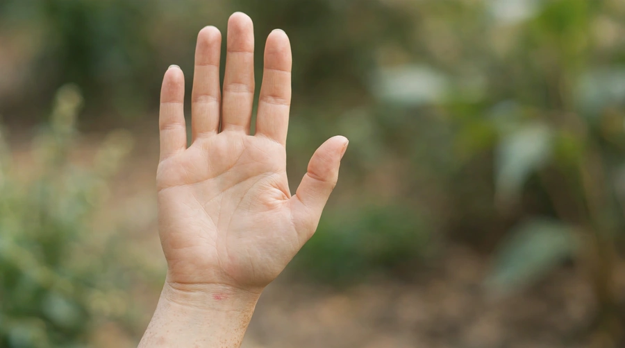 A calm open hand with a small red mark near the wrist.